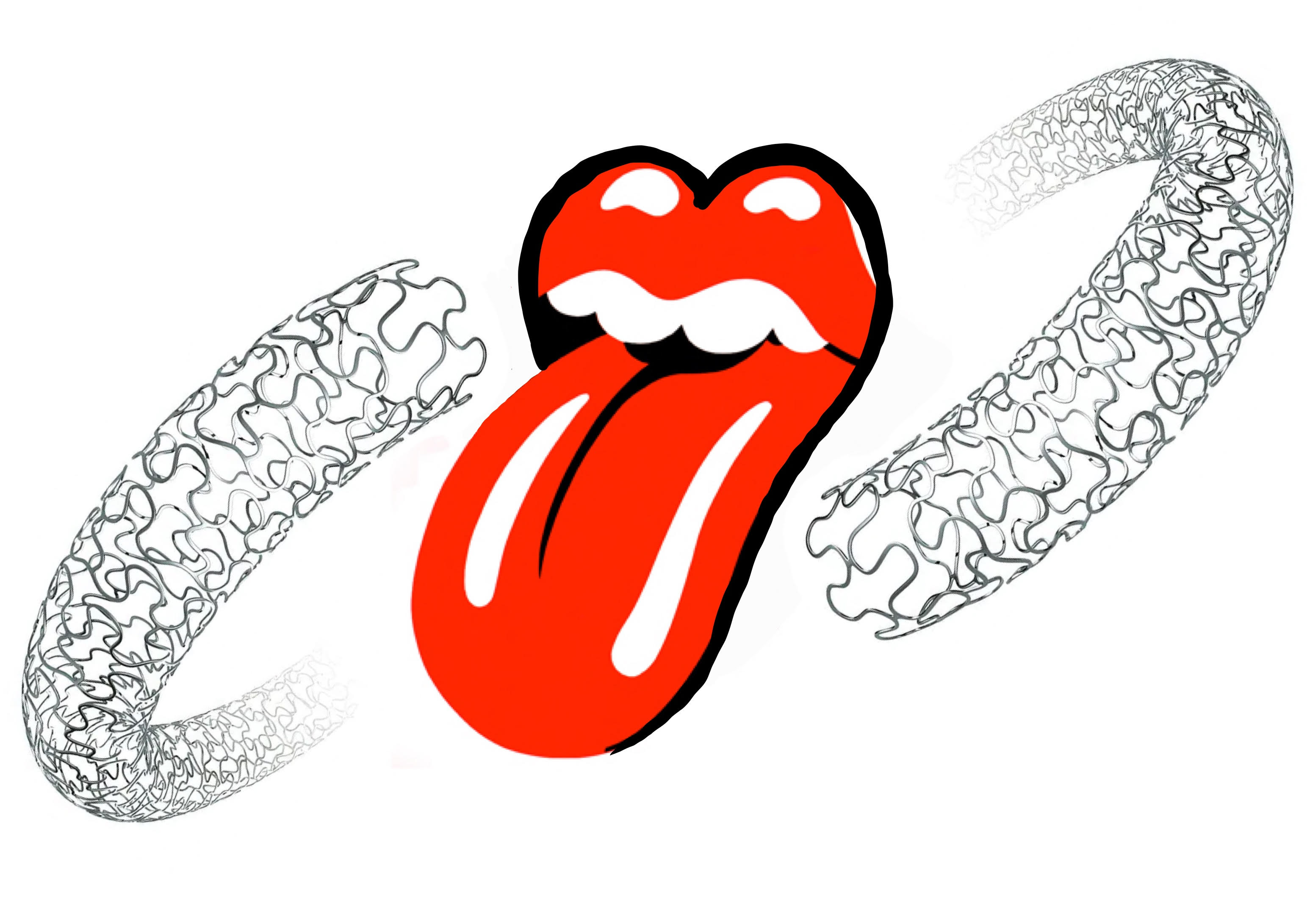 The Rolling Stents